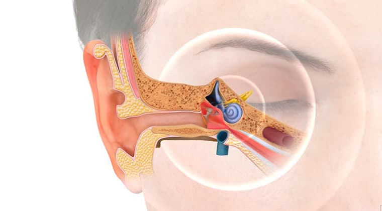 Fondo de Tinnitus