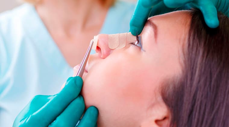 Rinoplastia funcional (por problemas respiratorios)